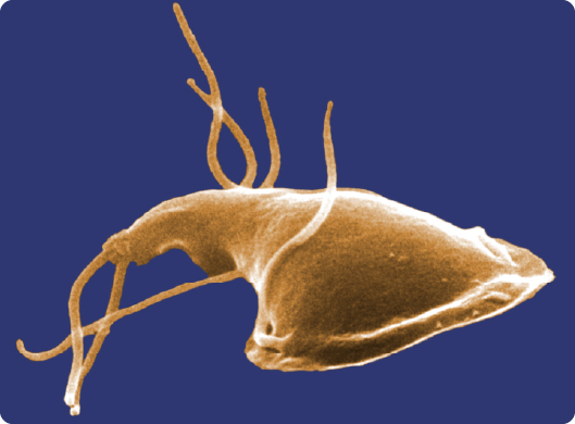 A digitally-colorized scanning electron microscopic (SEM) image depicting the  a&nbsp;Giardia&nbsp;protozoan.