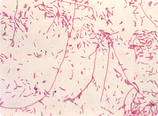 A photomicrograph depicting chains and solitary Legionella pneumophila&nbsp;bacteria.