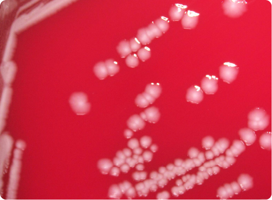 A magnified image of a colonial growth of Shigella sonnei&nbsp;bacteria.